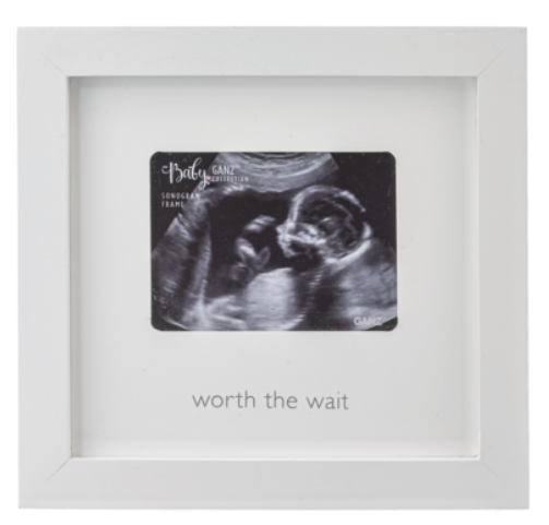 Sonogram Frame - Worth the Wait